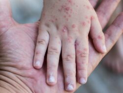 Imunisasi Campak Kaltim 2025 Masih Rendah, Ini Fakta dari Data BPS